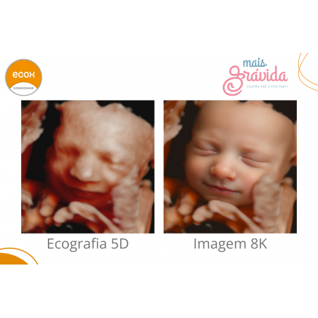 Ecografia 5D - COMPLETA + 8K + Real View