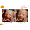 Ecografia 5D - COMPLETA + 8K + Real View